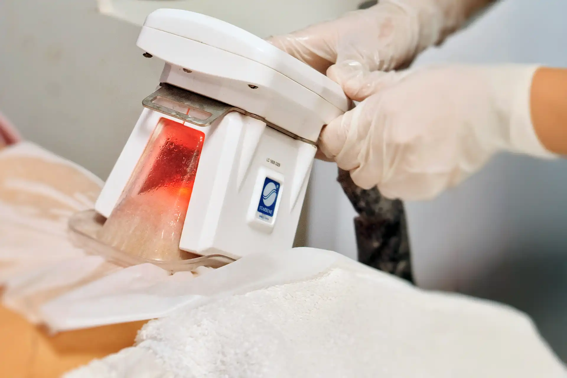 Imagen tratamiento corporal con equipamiento de criolipolisis